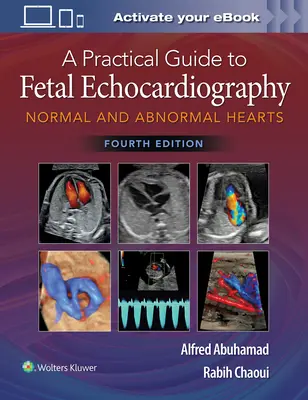 Praktický průvodce fetální echokardiografií: Normální a abnormální srdce - A Practical Guide to Fetal Echocardiography: Normal and Abnormal Hearts