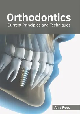 Ortodoncie: Současné principy a techniky - Orthodontics: Current Principles and Techniques