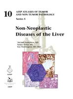 Neoplastická onemocnění jater - Non-Neoplastic Diseases of the Liver
