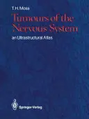 Nádory nervové soustavy: Ultrastrukturální atlas - Tumours of the Nervous System: An Ultrastructural Atlas
