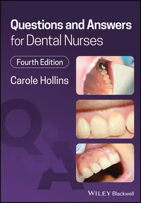Otázky a odpovědi pro zubní sestry - Questions and Answers for Dental Nurses