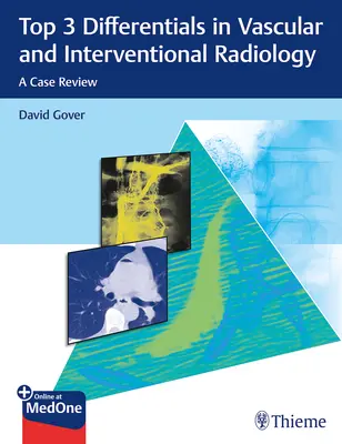 Top 3 diferenciály v cévní a intervenční radiologii: Případový přehled - Top 3 Differentials in Vascular and Interventional Radiology: A Case Review