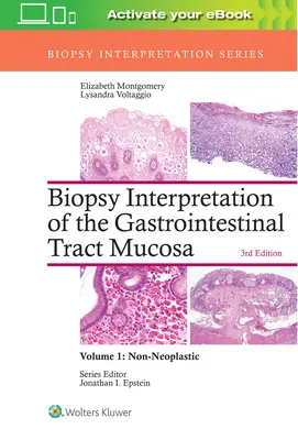 Interpretace biopsie sliznice gastrointestinálního traktu: 1. díl: Neoplastická diagnóza - Biopsy Interpretation of the Gastrointestinal Tract Mucosa: Volume 1: Non-Neoplastic