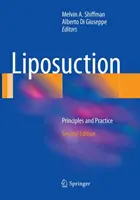 Liposukce: Zásady a praxe - Liposuction: Principles and Practice