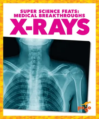 Rentgenové paprsky - X-Rays