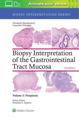 Interpretace biopsie sliznice gastrointestinálního traktu: 2. díl: Nádorové onemocnění - Biopsy Interpretation of the Gastrointestinal Tract Mucosa: Volume 2: Neoplastic