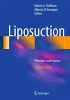 Liposukce: Zásady a praxe - Liposuction: Principles and Practice