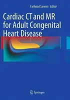 CT a MR srdce u vrozených srdečních vad dospělých - Cardiac CT and MR for Adult Congenital Heart Disease
