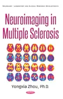 Neurozobrazování u roztroušené sklerózy - Neuroimaging in Multiple Sclerosis