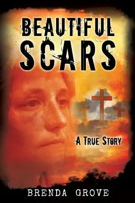 Krásné jizvy - Beautiful Scars