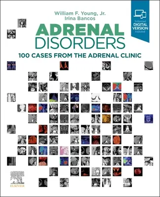Poruchy nadledvin: 100 případů z adrenální kliniky - Adrenal Disorders: 100 Cases from the Adrenal Clinic