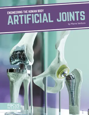 Umělé spoje - Artificial Joints