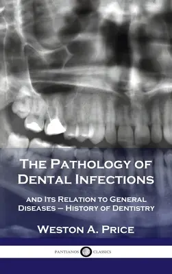 Patologie zubních infekcí: a její vztah k obecným onemocněním - Dějiny zubního lékařství - Pathology of Dental Infections: and Its Relation to General Diseases - History of Dentistry