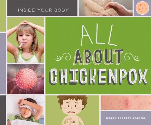 Vše o neštovicích - All about Chickenpox