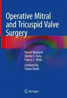 Operační chirurgie mitrální a trikuspidální chlopně - Operative Mitral and Tricuspid Valve Surgery