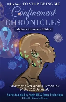 #Odmítám přestat být sám sebou: Kroniky porodu - edice pro uvědomění si alopecie - #Irefuse to Stop Being Me: Confinement Chronicles - Alopecia Awareness Edition