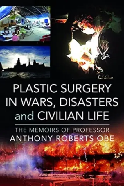 Plastická chirurgie ve válkách, katastrofách a civilním životě: Vzpomínky profesora Anthonyho Robertse OBE - Plastic Surgery in Wars, Disasters and Civilian Life: The Memoirs of Professor Anthony Roberts OBE