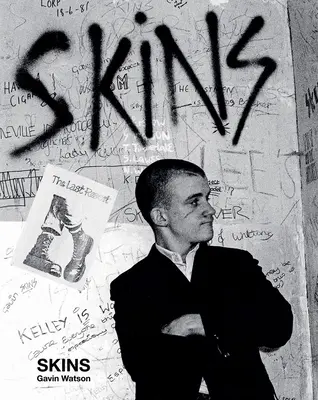 Kůže: Gavin Watson - Skins: Gavin Watson