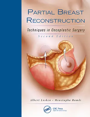 Částečná rekonstrukce prsu: Techniky v onkoplastické chirurgii - Partial Breast Reconstruction: Techniques in Oncoplastic Surgery