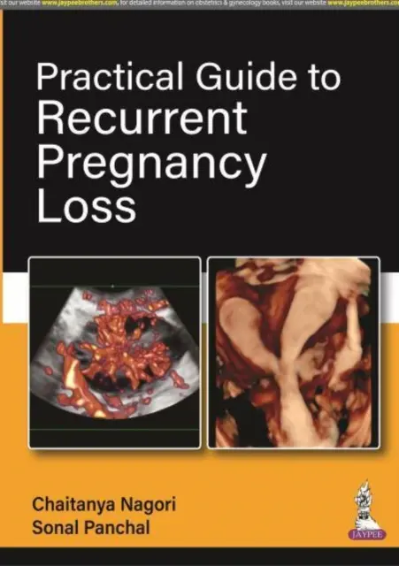 Praktický průvodce opakovanými těhotenskými ztrátami - Practical Guide to Recurrent Pregnancy Loss