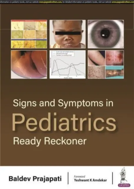 Příznaky a symptomy v pediatrii - Ready Reckoner - Signs and Symptoms in Pediatrics - Ready Reckoner