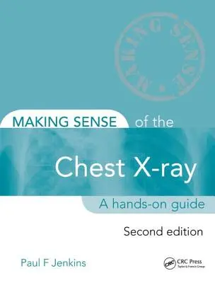 Making Sense of the Chest X-Ray: Příručka pro praktické využití - Making Sense of the Chest X-Ray: A Hands-On Guide