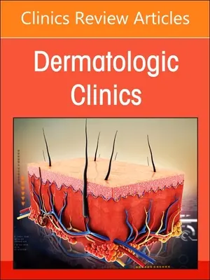 Diagnosing Skin Disease in Skin of Color, an Issue of Dermatologic Clinics: Svazek 41-3 - Diagnosing Skin Disease in Skin of Color, an Issue of Dermatologic Clinics: Volume 41-3