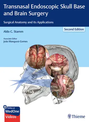 Transnazální endoskopická chirurgie lební baze a mozku: Chirurgická anatomie a její aplikace - Transnasal Endoscopic Skull Base and Brain Surgery: Surgical Anatomy and Its Applications