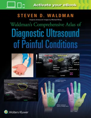 Waldmanův komplexní atlas diagnostického ultrazvuku bolestivých stavů - Waldman's Comprehensive Atlas of Diagnostic Ultrasound of Painful Conditions