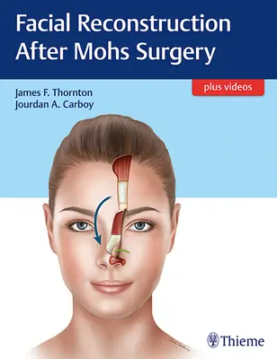 Rekonstrukce obličeje po Mohsově operaci - Facial Reconstruction After Mohs Surgery