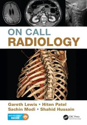 Radiologie na zavolání - On Call Radiology