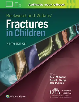 Rockwoodovy a Wilkinsovy zlomeniny u dětí - Rockwood and Wilkins Fractures in Children