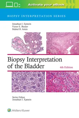Interpretace biopsie močového měchýře - Biopsy Interpretation of the Bladder