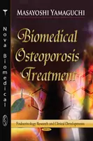 Biomedicínská léčba osteoporózy - nový vývoj s funkčními potravinovými faktory - Biomedical Osteoporosis Treatment - New Development with Functional Food Factors