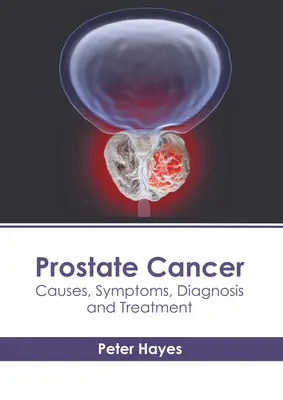 Rakovina prostaty: Příčiny, příznaky, diagnostika a léčba - Prostate Cancer: Causes, Symptoms, Diagnosis and Treatment