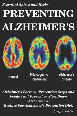 Prevence Alzheimerovy choroby: Alzheimerova choroba: Faktory Alzheimerovy choroby, preventivní kroky a potraviny, které zabraňují Alzheimerově chorobě nebo ji zpomalují, Recepty pro prevenci Alzheimerovy choroby D - Preventing Alzheimer's: Alzheimer's Factors, Prevention Steps and Foods That Prevent or Slow Alzheimer's, Recipes for Alzheimer's Prevention D