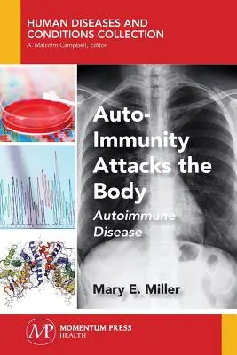 Autoimunita útočí na tělo: Autoimunitní onemocnění - Auto-Immunity Attacks the Body: Autoimmune Disease