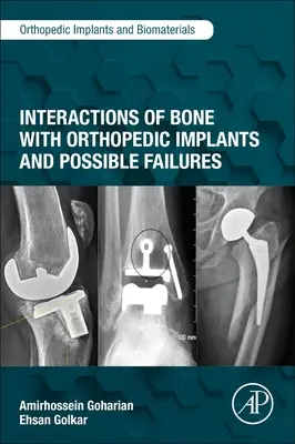 Interakce kostí s ortopedickými implantáty a jejich možná selhání - Interactions of Bone with Orthopedic Implants and Possible Failures