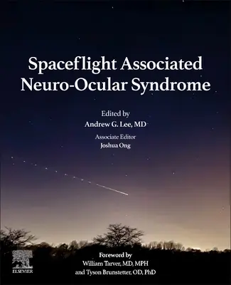 Neuro-okulární syndrom spojený s kosmickými lety - Spaceflight Associated Neuro-Ocular Syndrome