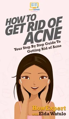 Jak se zbavit akné: Váš průvodce krok za krokem, jak se zbavit akné - How To Get Rid of Acne: Your Step By Step Guide To Getting Rid of Acne