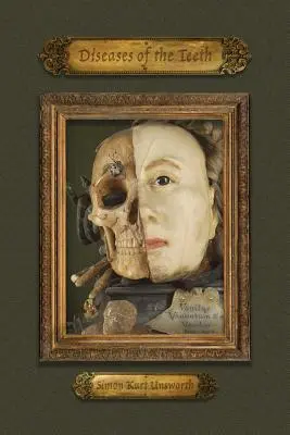 Nemoci zubů - Diseases of the Teeth