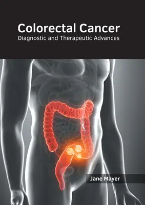 Rakovina tlustého střeva: Diagnostické a terapeutické pokroky - Colorectal Cancer: Diagnostic and Therapeutic Advances