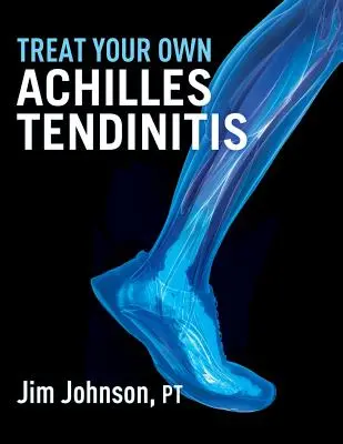 Léčba vlastní Achillovy šlachy - Treat Your Own Achilles Tendinitis