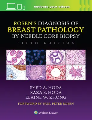 Rosenova diagnostika patologie prsu pomocí jehlové jádrové biopsie - Rosen's Diagnosis of Breast Pathology by Needle Core Biopsy