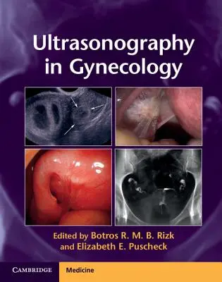 Ultrasonografie v gynekologii - Ultrasonography in Gynecology