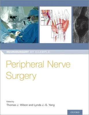 Operace periferních nervů - Peripheral Nerve Surgery