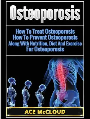 Osteoporóza: Jak léčit osteoporózu: Jak předcházet osteoporóze: Výživa, dieta a cvičení pro osteoporózu: Jak se bránit osteoporóze? - Osteoporosis: How To Treat Osteoporosis: How To Prevent Osteoporosis: Along With Nutrition, Diet And Exercise For Osteoporosis