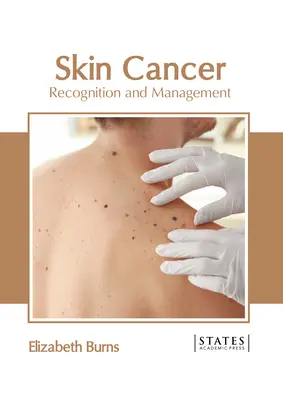 Rakovina kůže: Rozpoznání a léčba - Skin Cancer: Recognition and Management