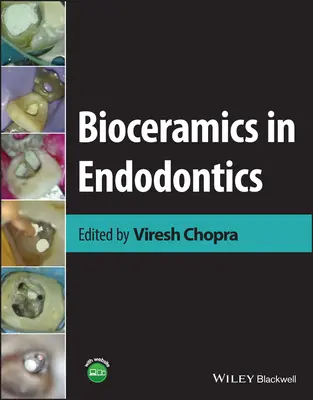 Biokeramika v endodoncii - Bioceramics in Endodontics