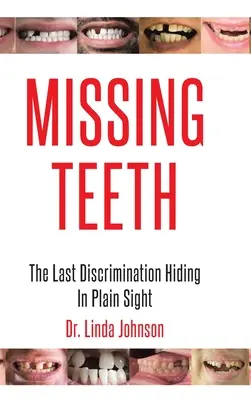 Chybějící zuby: Poslední diskriminace se skrývá na první pohled - Missing Teeth: The Last Discrimination Hiding in Plain Sight